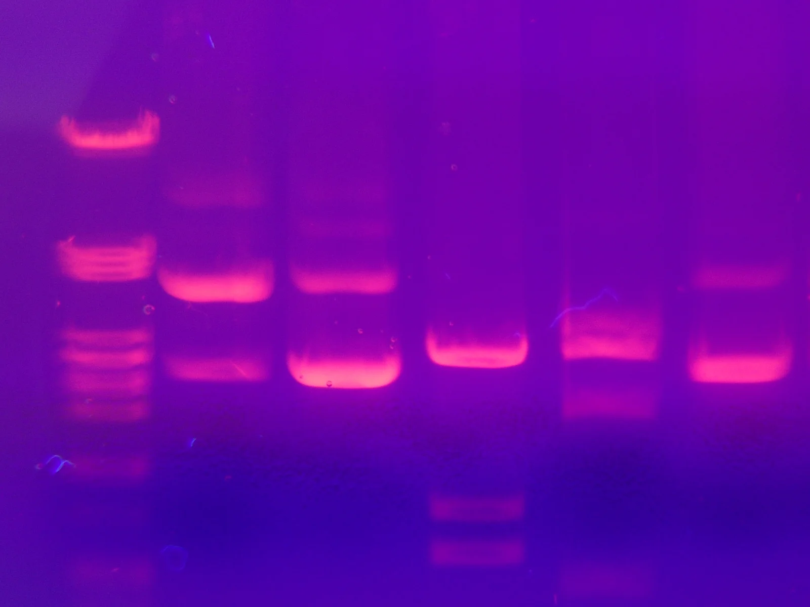 DNA fragments separated by gel electrophoresis in a laboratory